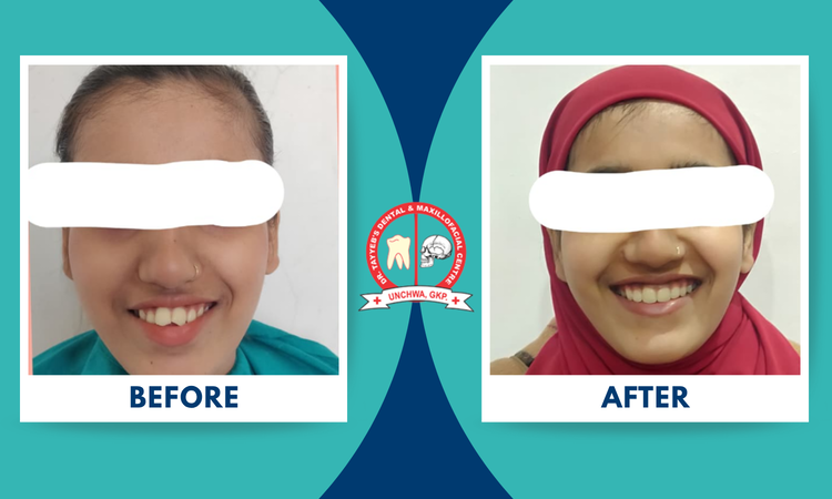 braces treatment at dr tayyeb's